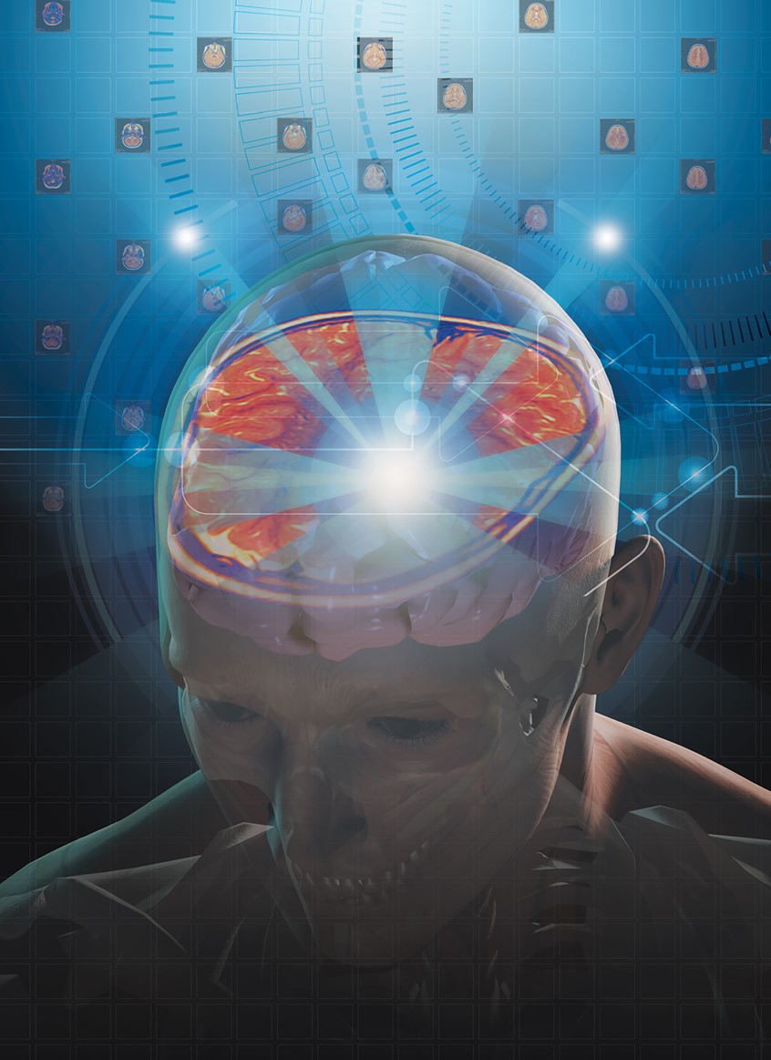 medical illustration of F/C illustration depicting a a view of the brain, digital image, 3D, 3D character, photoshop image, photo-realism, realistic images, retouching 3D imaging, images of cutaways, technical images, science, scientific images, vector images, product images, medical, pharmaceutical, conceptual images, humor, animals, dinosaurs, landscapes, fantasy, people, corporate, book covers, magazines, fantasy.