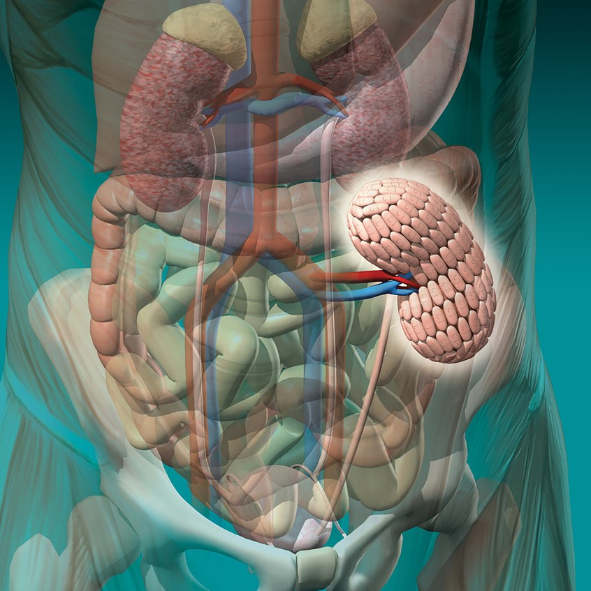 medical illustration of F/C illustration depicting the protection of kidney transplant, digital image, 3D, 3D character, Photoshop image, photo-realism, realistic images, retouching 3D imaging, images of cutaways, technical images, science, scientific images, vector images, product images, medical, pharmaceutical, conceptual images, humor, animals, dinosaurs, landscapes, fantasy, people, corporate, book covers, magazines, fantasy.