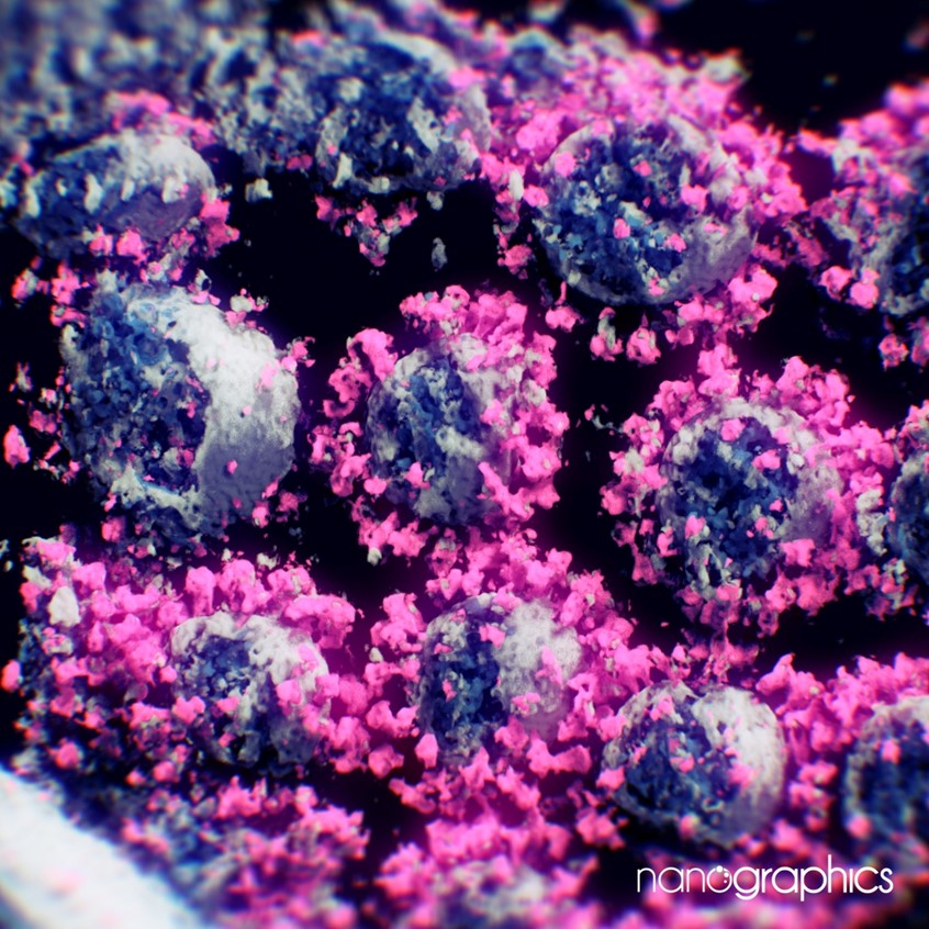 medical illustration of This is an electron cryotomography scan of real SARS-CoV-2 virions. With our in-house visualization software, we were able to visualize this scan in unprecedented detail, giving researchers and the public a unique view of particles of a virus responsible for the global pandemic of Covid-19.