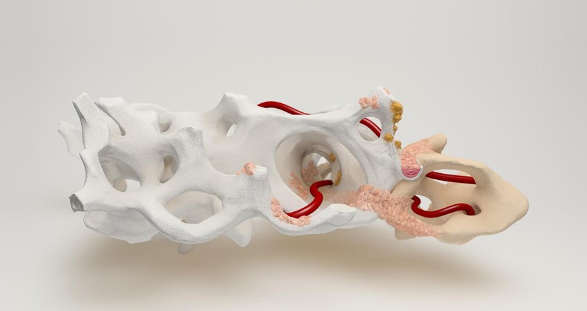 medical illustration of Quaint’s first 3D rendering – showing the regneration process with a bone particle biomaterial, from clean product (left) to vascularization, cell colonization and resorption into the body (right).