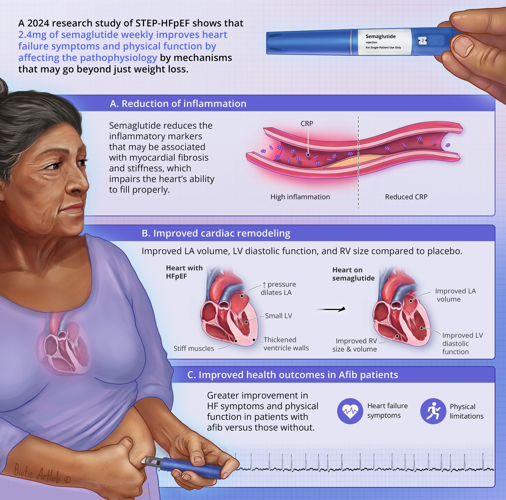 goodrx for tirzepatide What Is Zepbound (tirzepatide)? Uses, Side Effects, Dosage goodrx for tirzepatide What Is Zepbound (tirzepatide)? Uses, Side Effects, Dosage
