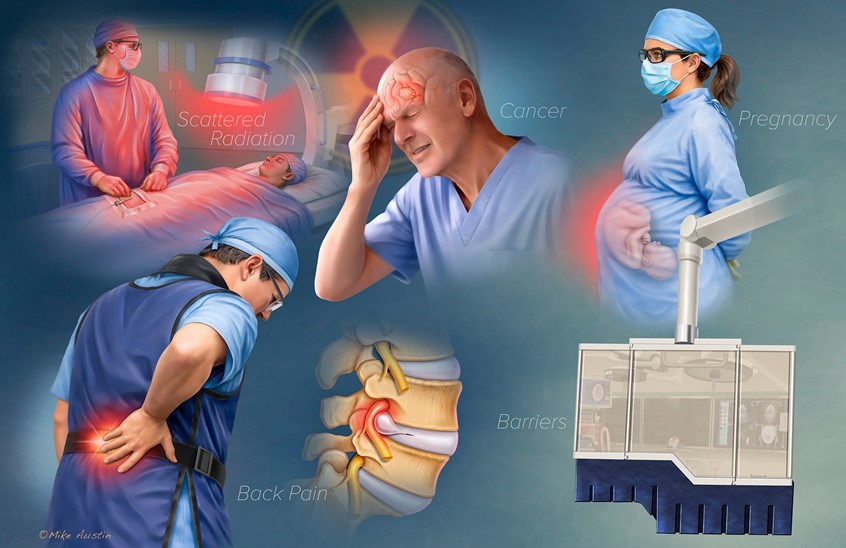 medical illustration of This illustration highlights the occupational risks faced by healthcare professionals working in fluoroscopic laboratories. Prolonged exposure to ionizing radiation places clinicians at increased risk for cancer, cataracts, and reproductive health concerns. In addition, the long-term use of heavy lead aprons—while essential for radiation protection—contributes to chronic orthopedic strain and musculoskeletal injury.