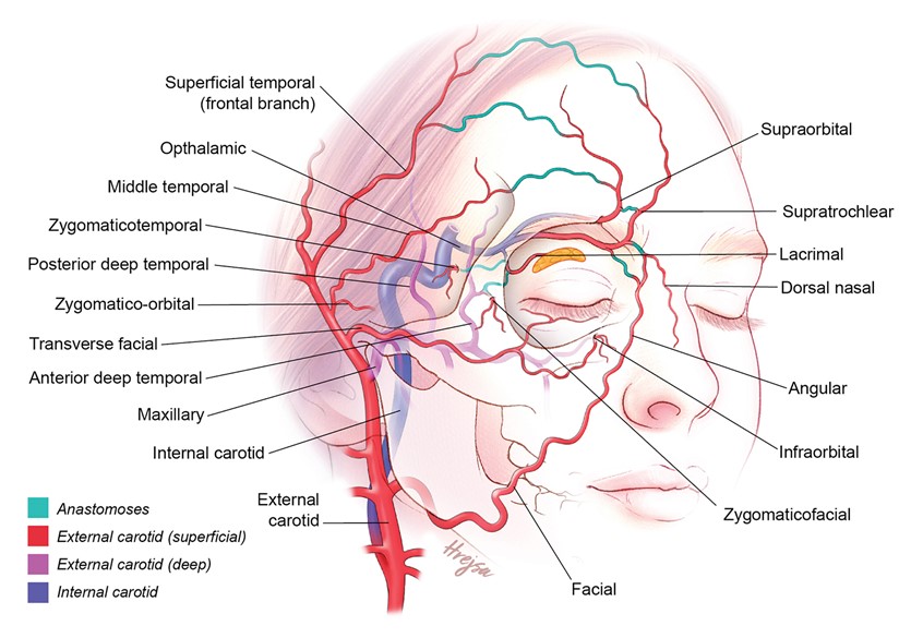 medical illustration of This anatomical illustration depicts the facial arteries and their anastomoses, highlighting the external carotid artery and its branches. It shows the pathway of the facial artery as it supplies blood to the face. This detailed representation serves as an educational tool for medical students and healthcare professionals, enhancing understanding of vascular anatomy and its clinical significance in facial surgeries and assessments.