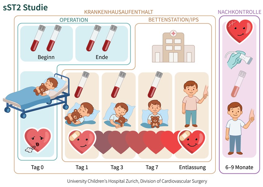 medical illustration of Cartoon-style medical illustration depicting the timeline of blood draws in a pediatric patient undergoing congenital heart surgery, part of a translational research study on the sST2 biomarker in heart failure. A young boy in a hospital setting shows labeled vials for each collection point—from perioperative stages to postoperative days. A cartoon heart character transitions from stressed to happy, symbolizing recovery. © University Children's Hospital Zurich.