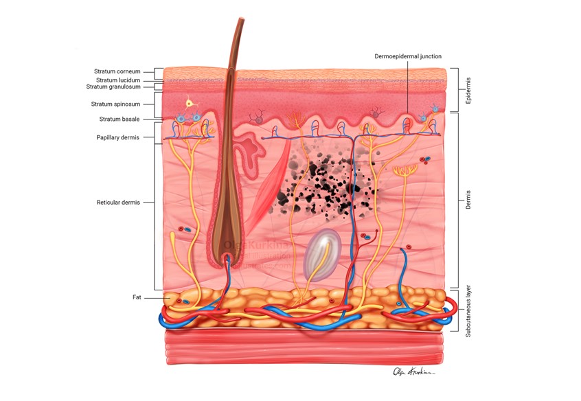 medical illustration of Medical illustration showing a cross-section of human skin after tattoo healing.
The image depicts the epidermis, dermis, and subcutaneous tissue, with stabilized pigment particles distributed within the dermal layer following the healing process.
Created for Jagiellonian University.