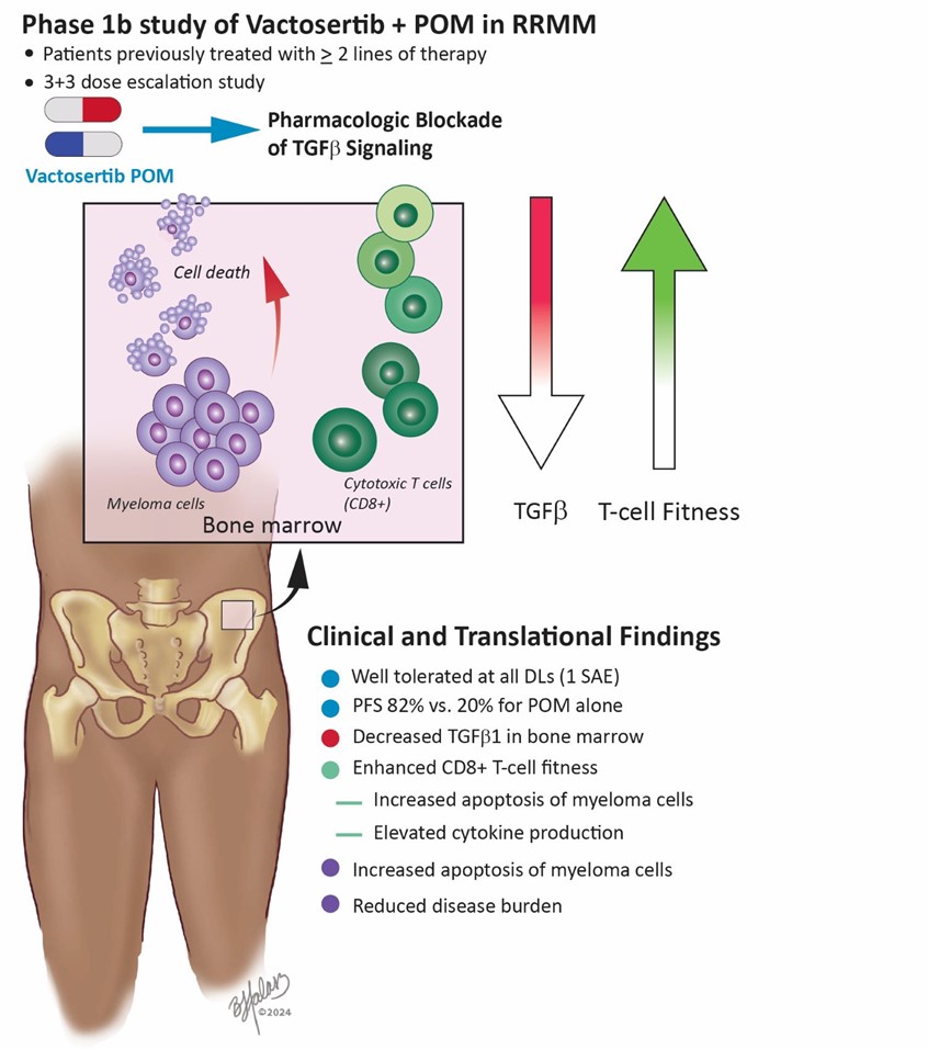 medical illustration of Phase 1b study of kinase inhibitor Vactosertib + POM in RRMM. Pharmacologic blockade of TGF beta signaling. Bone marrow -stem cell treatment.