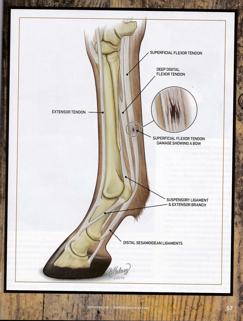 medical illustration of Created for Horse Illustrated magazine, this image shows damage in the equine flexor tendon. Inset shows the bowed (bowing) tendon on the superficial flexor tendon on the cannon bone.