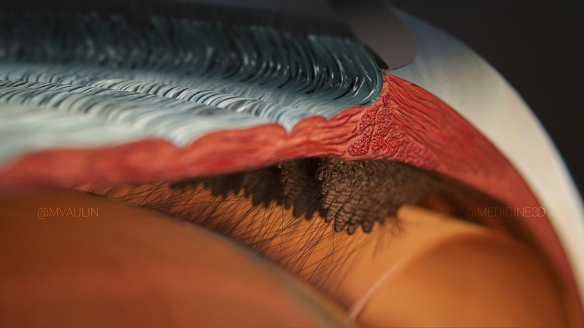 medical illustration of 3D visualisation of the angle of the anterior chamber of the human eye. It shows the trabecular meshwork, ciliary body, suspensory ligaments, the contour of lens, iris root with inside structural muscles.
This image is a part of ophthalmology visualisation project show in my portfolio.
