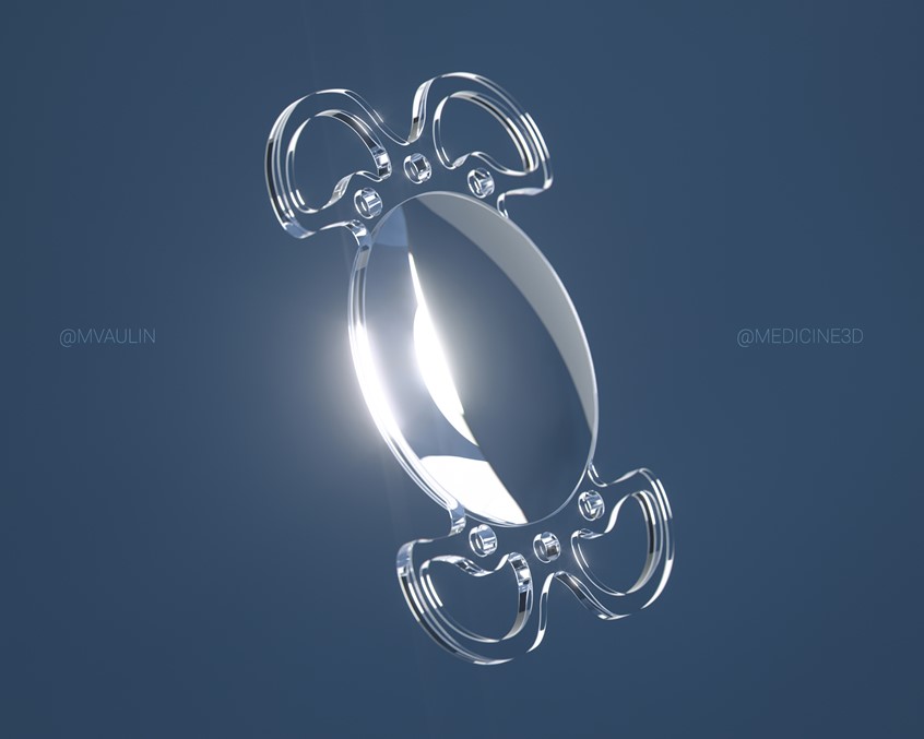 medical illustration of 3d model IOL was made for exhibition stand. Such lens is used to replace the lens of the human eye during a phacoemulsification operation.
This lens has some special features, such as a special haptic elements for stitching inside the eye.