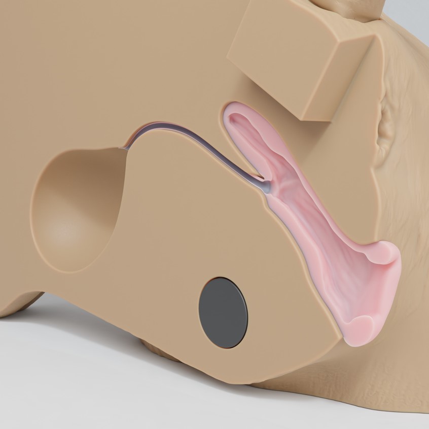 medical illustration of 3D design of a task-trainer for the procedure of catheterization of a dog.
The model is based on canine back sliced by a sagittal plane into two halves.
It imitates canine urinary tract with vagina, urethra and bladder that can be filled with liquid.