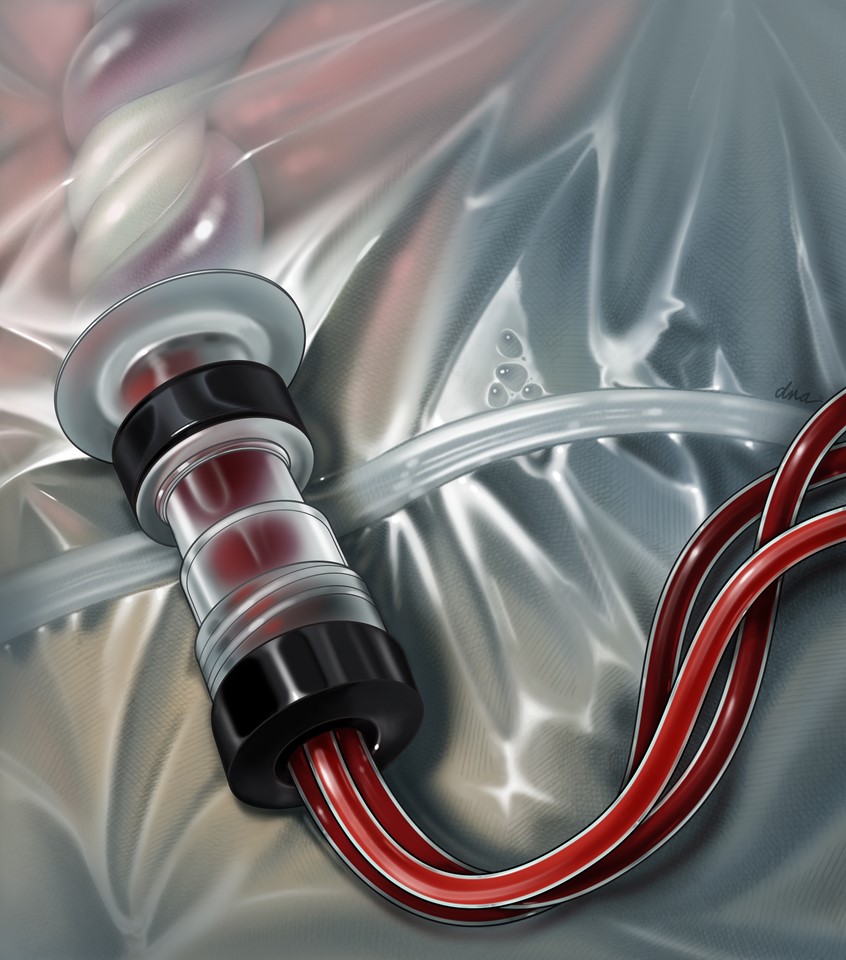 medical illustration of This medical illustration highlights the core function of the artificial womb by focusing on the contrast between the organic nature of the umbilical cord and the artificial surrounds of the BioBag. The composition centers on the umbilical vessels—one oxygen-rich vein and two darker arteries— and the tubes used to connect to the oxygenator. A soft, abstracted form in the upper left corner subtly alludes to the system’s intended use: providing physiological support of still developing fetuses.