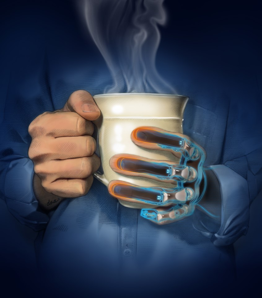 medical illustration of Medical illustration to accompany an article exploring research aimed at restoring touch, proprioception, and temperature sensation in prosthetic hands through intraneural stimulation, sensory substitution, and wearable technology. An electric-blue line traces the artificial digits and transitions to hot orange at the fingertips, providing a visual representation of the prosthesis detecting heat, while a ghosted image of a natural, biological hand surrounds the prosthesis