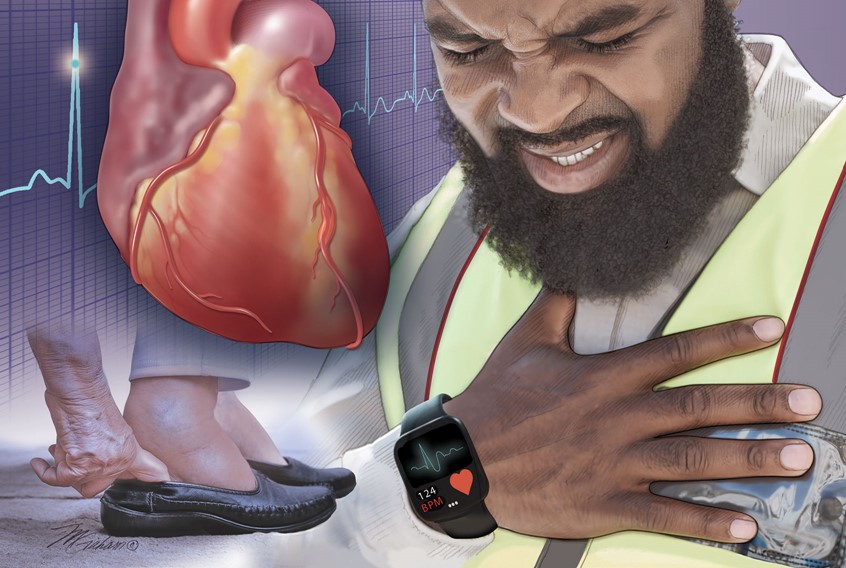 medical illustration of Cardiovascular symptoms can include chest pain and swollen feet and will commonly affect the left anterior descending artery (LAD) of the heart.