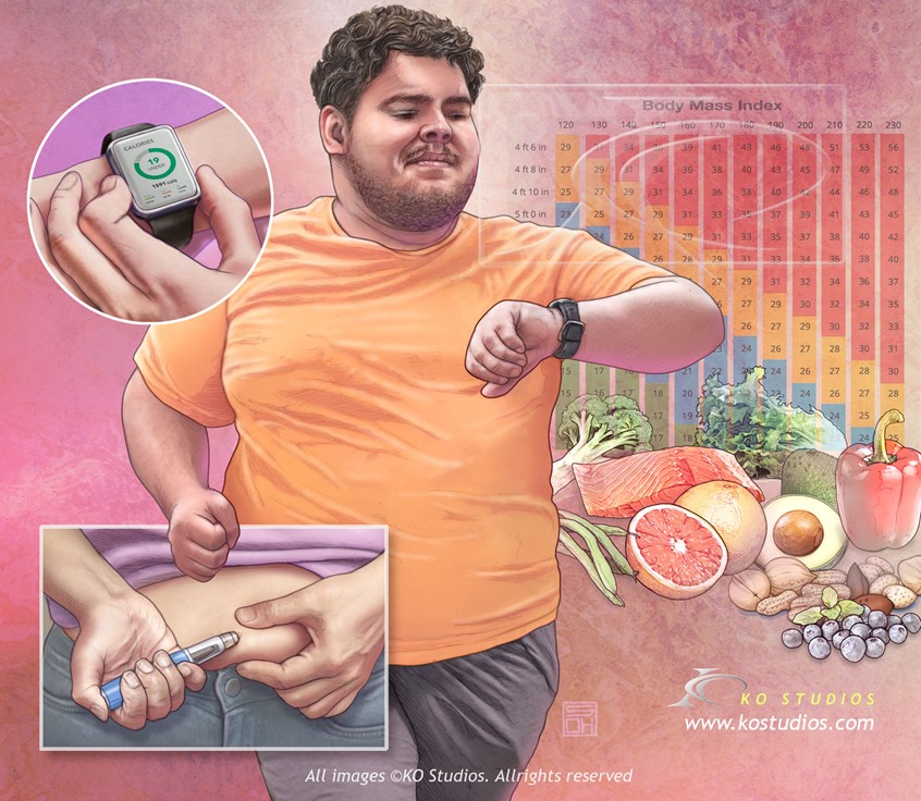 medical illustration of Obesity treatment and management involves focusing on initial weight loss through lifelong lifestyle changes, including diet (calorie restriction), physical activity, and behavioral therapy. further options include FDA-approved medications (e.g., GLP-1 agonists like Ozempic, Wegovy or semaglutide) and bariatric surgery for significant, long-term, and sustainable weight loss.
Track BMI values.