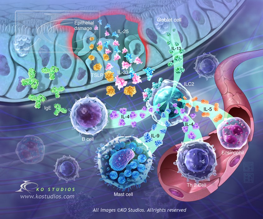 medical illustration of Cover image of JACI illustrates type 2 innate lymphoid cells (ILC2s) which are the first line of defense immune cells that lack antigen-specific receptors. They reside in mucosal and barrier tissues of lungs, skin, and gut and produce cytokines (such as IL-5, IL-9, and IL-13) in response to allergens, tissue injury, and parasitic infections.