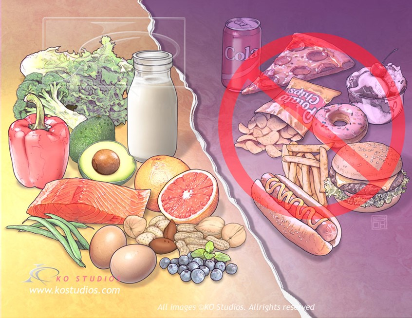 medical illustration of Illustration depicts the difference between healthy and non-healthy foods. Health foods are nutrient-dense, whole foods that provide the body with essential vitamins, minerals, proteins, and healthy fats while minimizing refined sugars, sodium, and trans fats. Consuming these foods is foundational for maintaining overall well-being and reducing the risk of chronic diseases, heart problems, gastrointestinal problems and stress.