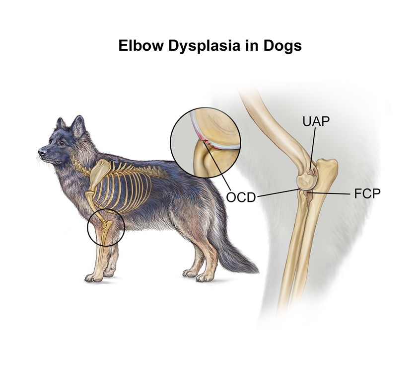 medical illustration of The elbow joint of the dog showing 3 areas of abnormal bone growth and/or development leading to elbow dysplasia health conditions; OCD (Osteochondrosis of the medial humeral condyle), UAP (Ununited anconeal process), and FCP (Fragmented coronoid process).