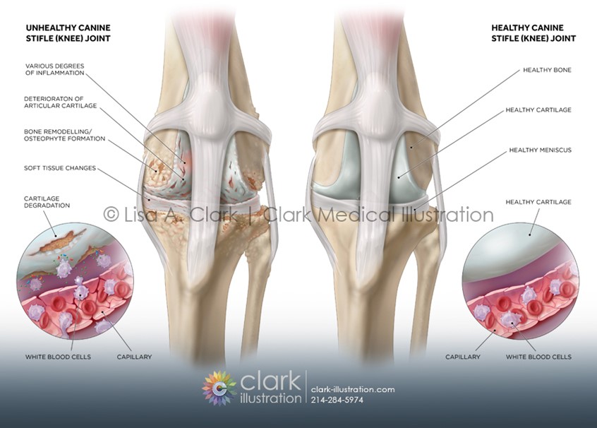 medical illustration of The stifle joint is the dog's equivalent of the human knee — a hinge joint where the thigh bone (femur) meets the shin bone (tibia) and the kneecap (patella). When osteoarthritis develops, joint cartilage gradually breaks down — leading to bone-on-bone friction, the formation of bone spurs, and chronic pain.