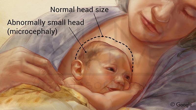 Medical Illustration and Animation :: Association of Medical Illustrators