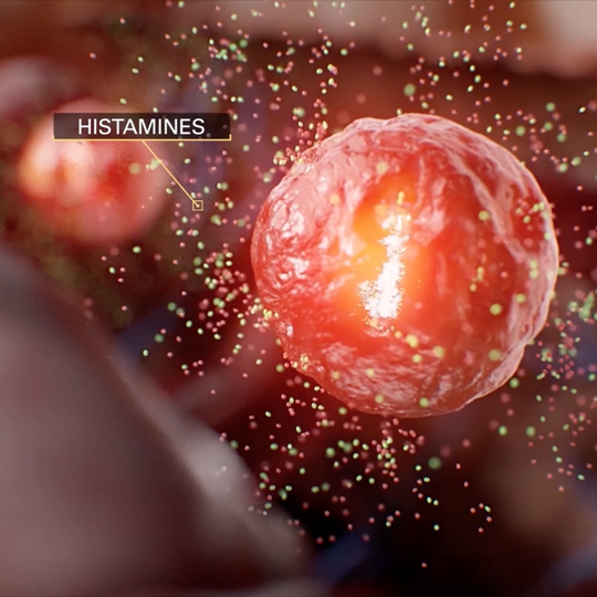 Crohn's Disease MD Animation by MadMicrobe Studios Medical