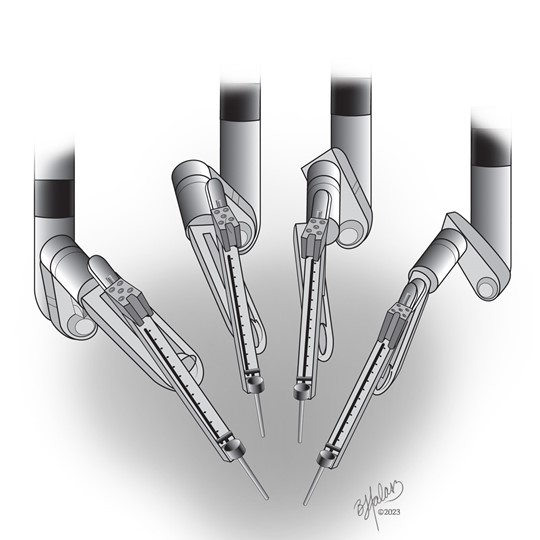 Beth Halasz - Medical Illustration & Animation | Chardon